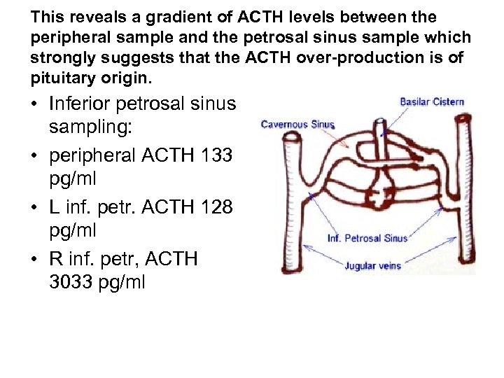 This reveals a gradient of ACTH levels between the peripheral sample and the petrosal