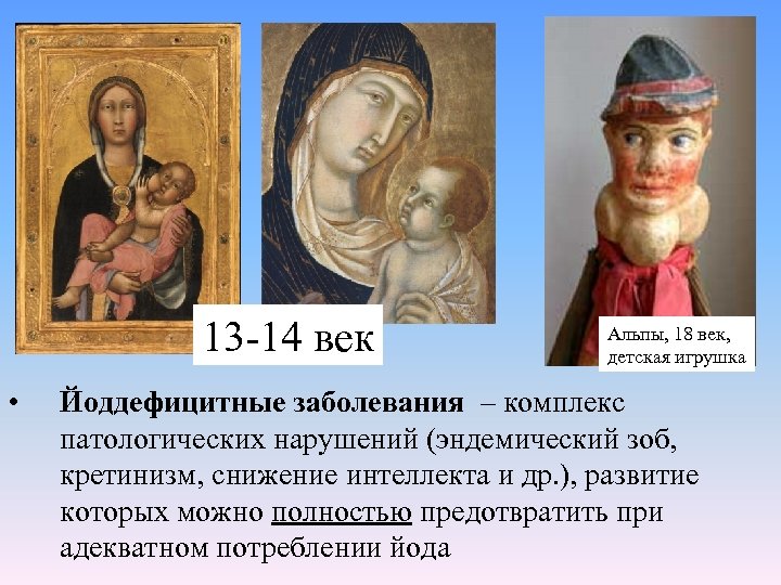 13 -14 век • Альпы, 18 век, детская игрушка Йоддефицитные заболевания – комплекс патологических