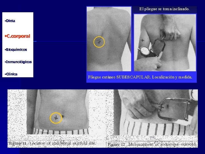  • Dieta • C. corporal • Bioquímicos • Inmunológicos • Clínica 