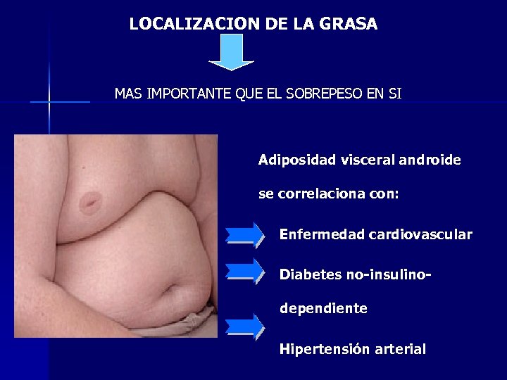 LOCALIZACION DE LA GRASA MAS IMPORTANTE QUE EL SOBREPESO EN SI Adiposidad visceral androide