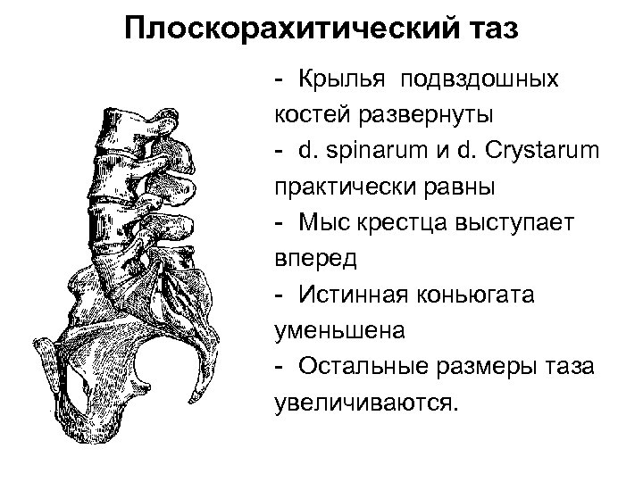 Крылья таза фото