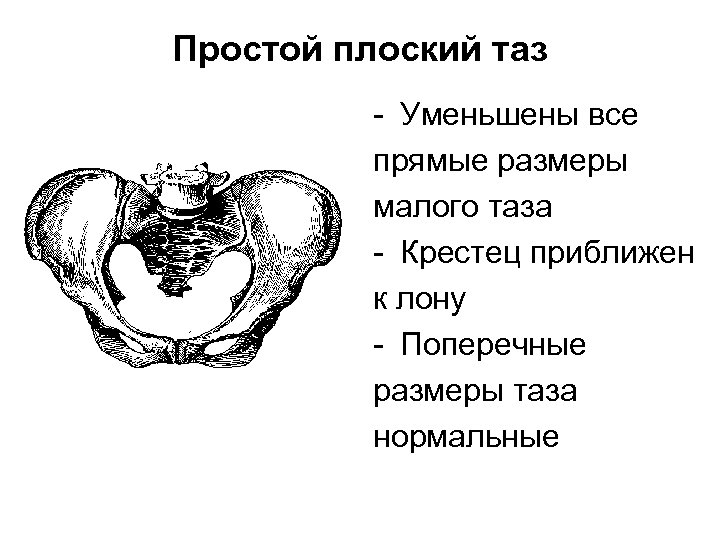 Рисунки малого таза