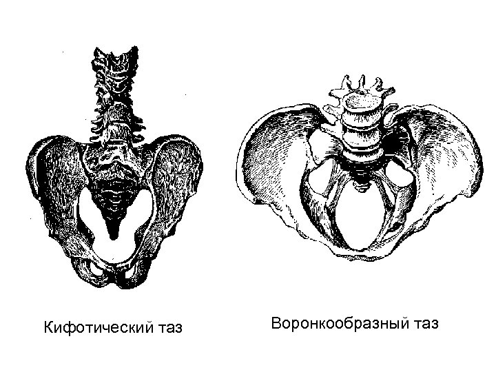 Таз человека фото