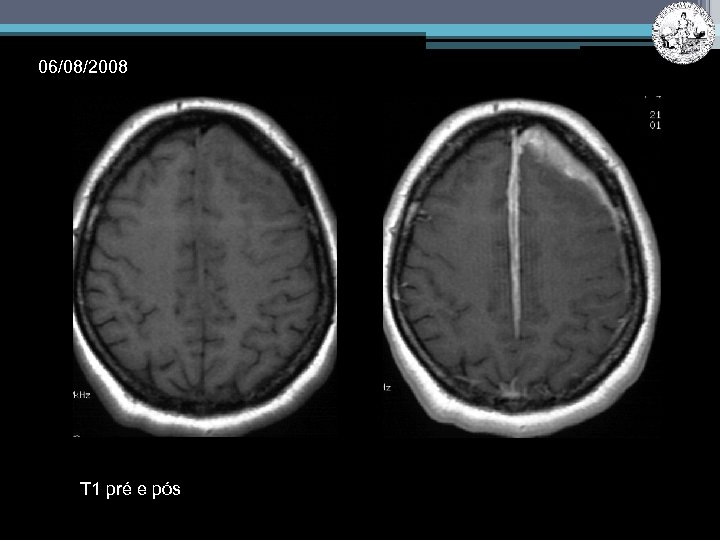 06/08/2008 T 1 pré e pós 