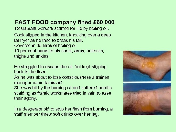 FAST FOOD company fined £ 60, 000 Restaurant workers scarred for life by boiling