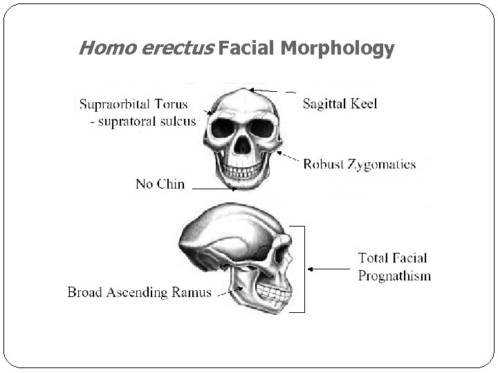 Homo erectus Facial Morphology 