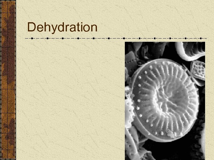 Dehydration 