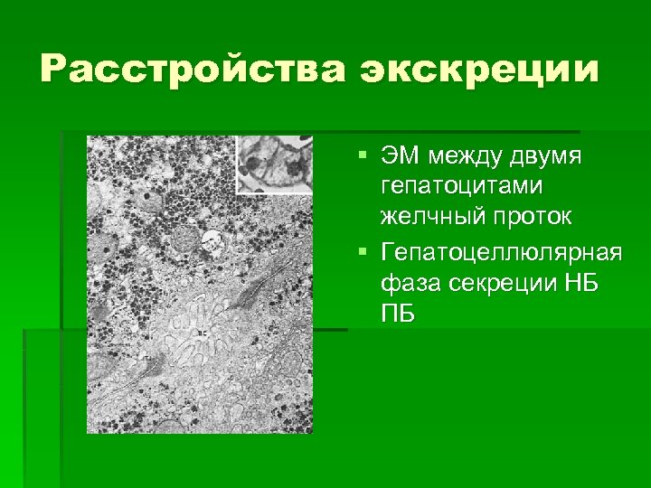 Расстройства экскреции § ЭМ между двумя гепатоцитами желчный проток § Гепатоцеллюлярная фаза секреции НБ