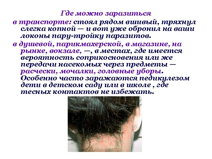 Где можно заразиться в транспорте: стоял рядом вшивый, тряхнул слегка копной — и вот