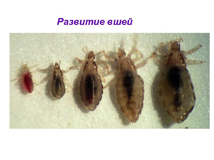 Развитие вшей 
