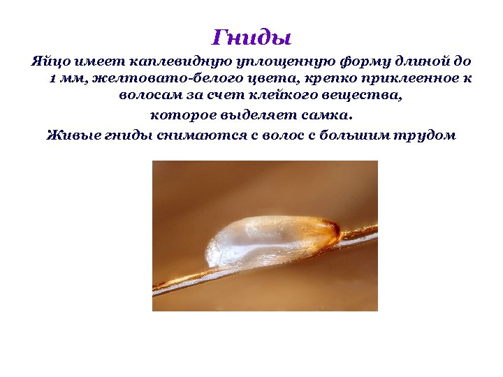 Гниды Яйцо имеет каплевидную уплощенную форму длиной до 1 мм, желтовато-белого цвета, крепко приклеенное