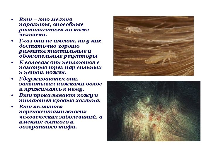  • • • Вши – это мелкие паразиты, способные располагаться на коже человека.