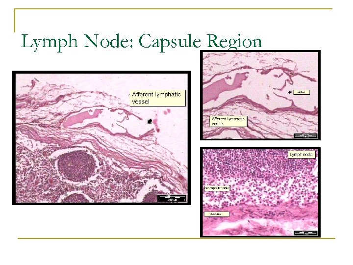 Lymph Node: Capsule Region 