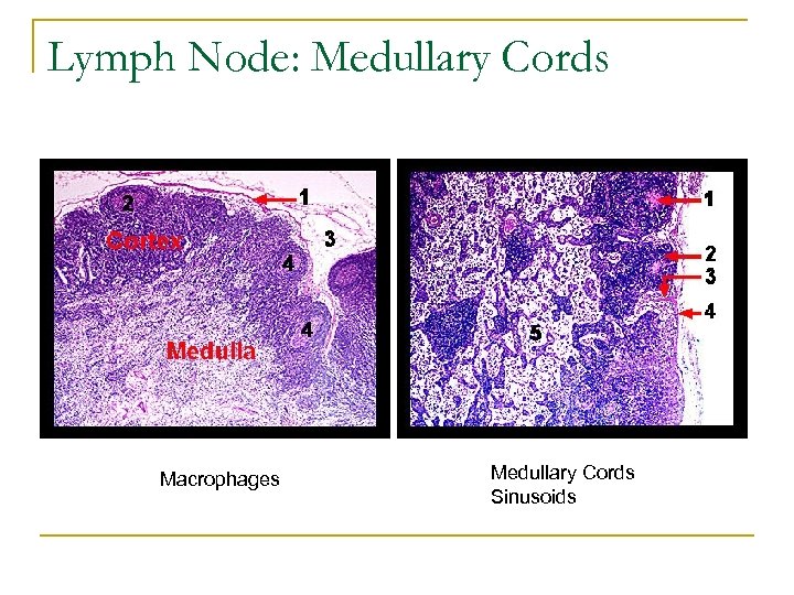 Lymph Node: Medullary Cords Macrophages Medullary Cords Sinusoids 