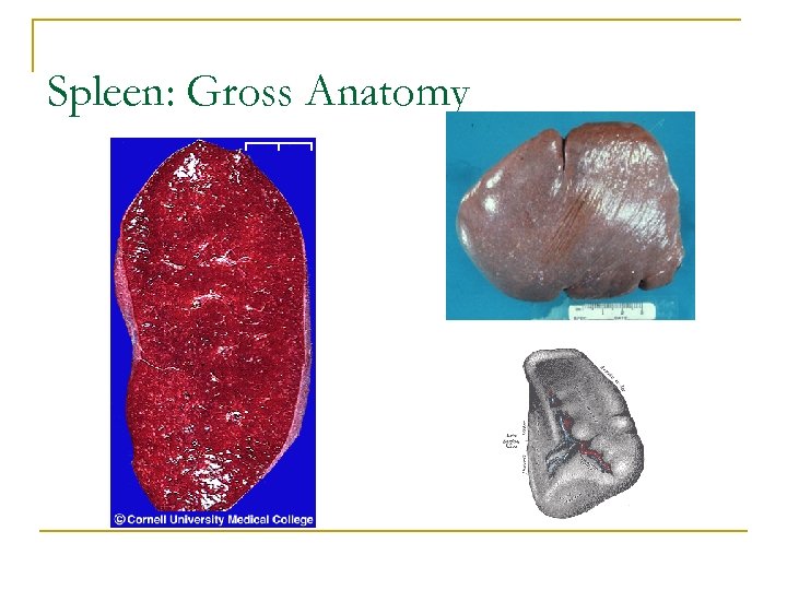 Spleen: Gross Anatomy 