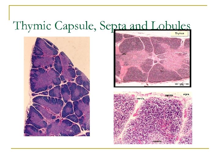 Thymic Capsule, Septa and Lobules 