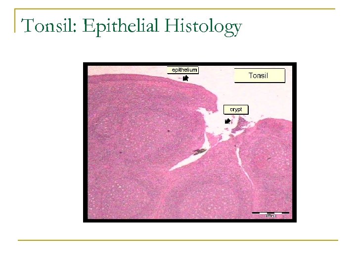 Tonsil: Epithelial Histology 