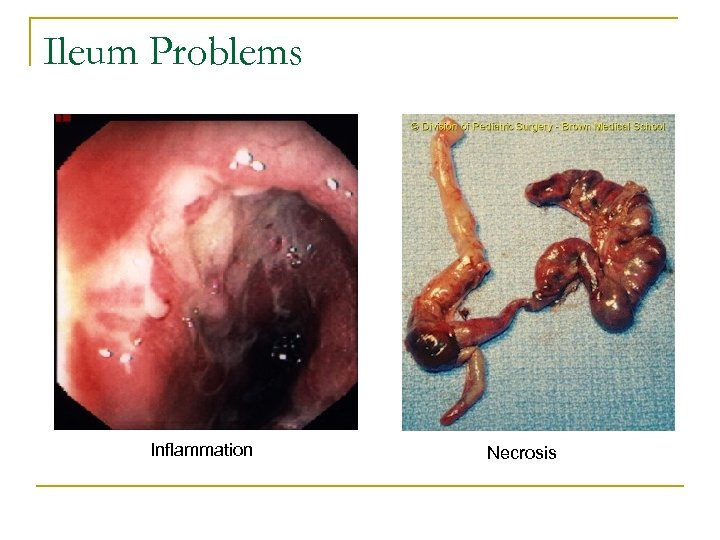 Ileum Problems Inflammation Necrosis 