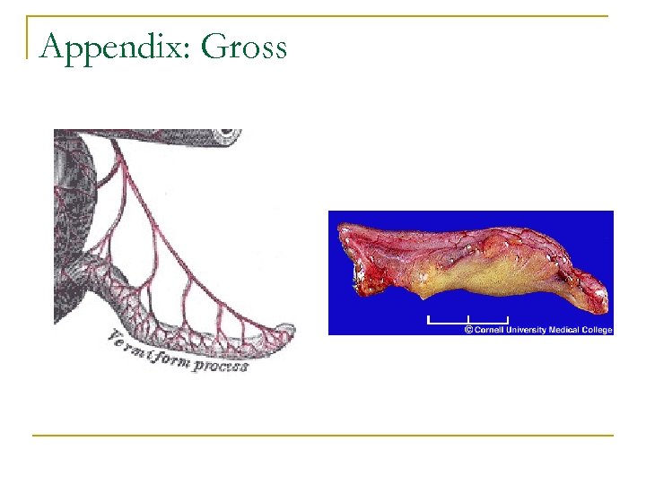 Appendix: Gross 