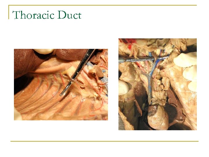 Thoracic Duct 