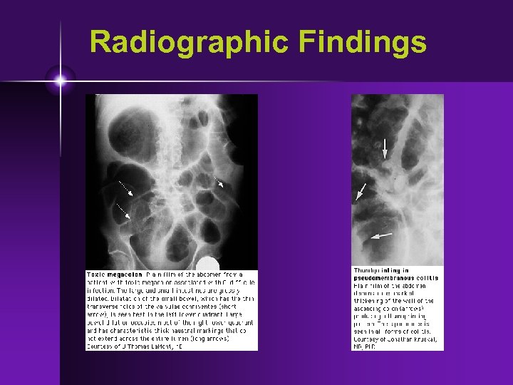 Radiographic Findings 