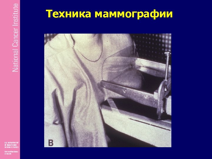 Техника маммографии 