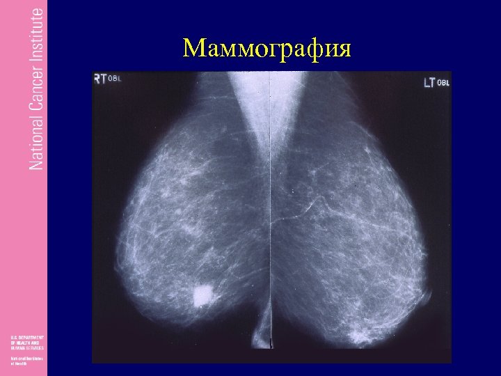 Институт маммографии