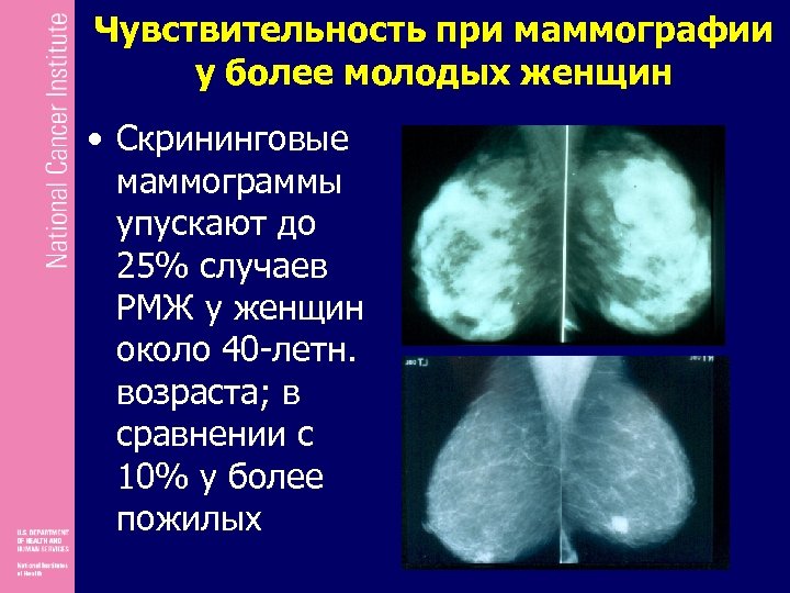 Маммография периодичность. Маммография примеры описания. Маммография картинки. Хорошие Результаты маммографии. Маммография молочных желез заключение.