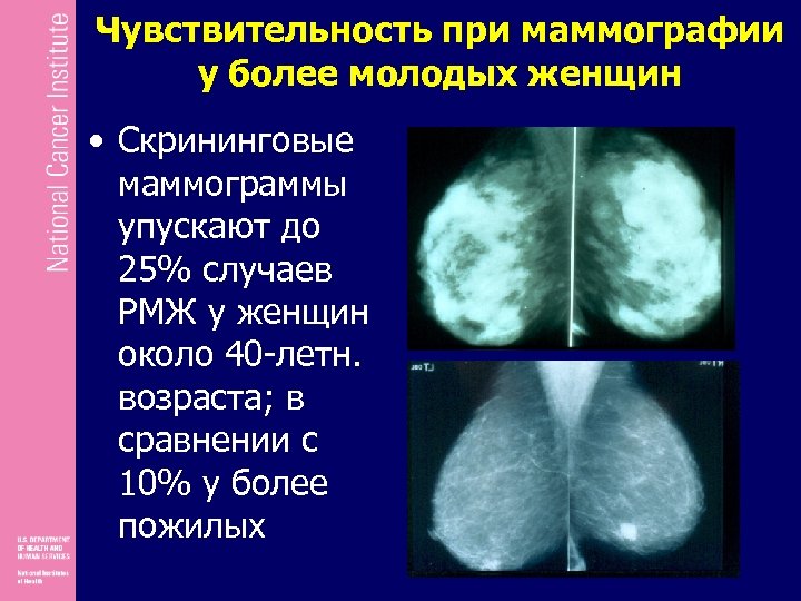 Маммограмма возраст. Маммограмма молодой женщины. Возрастные изменения на маммограмме. Возрастные изменения на маммограмме с описаниями.