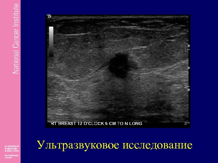 Ультразвуковое исследование 