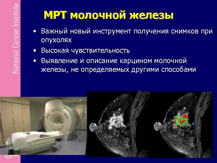 МРТ молочной железы • Важный новый инструмент получения снимков при опухолях • Высокая чувствительность