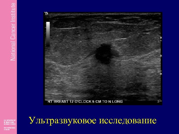 Ультразвуковое исследование 