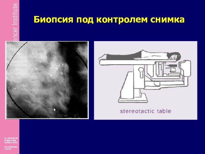 Биопсия под контролем снимка 