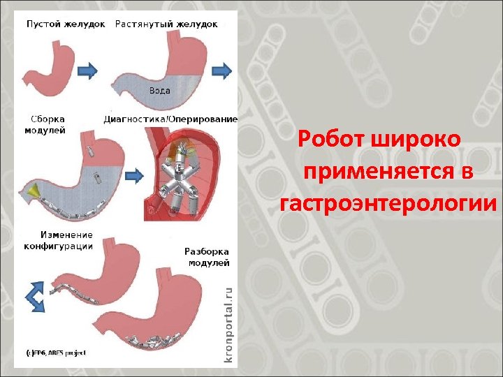 Как уменьшить размер желудка естественным. Нормальный и растянутый желудок. Признаки растянутого желудка.