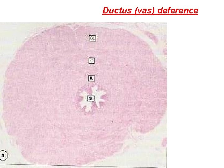 Ductus (vas) deference 