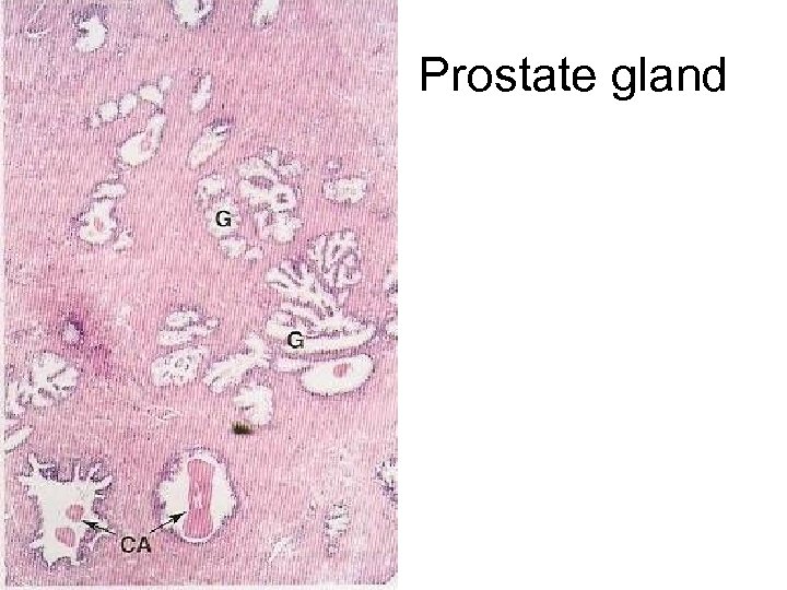 Prostate gland 
