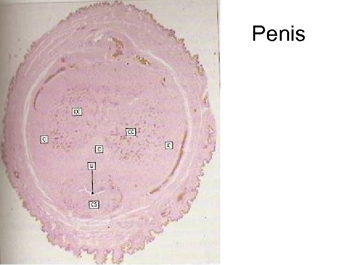 Penis 