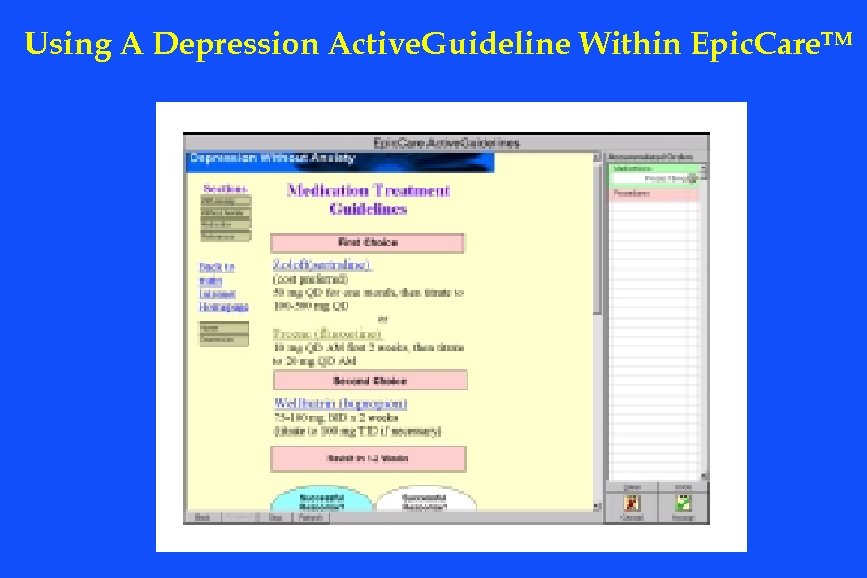 Using A Depression Active. Guideline Within Epic. Care. TM 