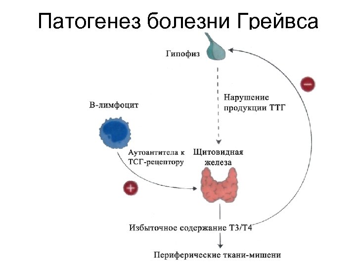 Токсический зоб этиология. Болезнь Грейвса патогенез. Базедова болезнь патогенез. Болезнь Грейвса базедова. Диффузный токсический зоб патогенез.