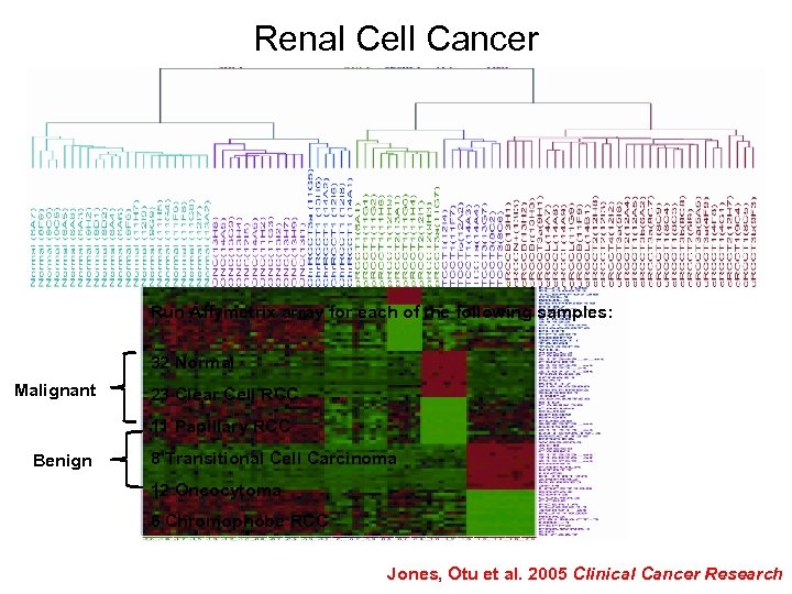Renal Cell Cancer Run Affymetrix array for each of the following samples: 32 Normal