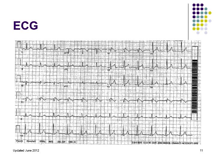 ECG Updated June 2012 11 