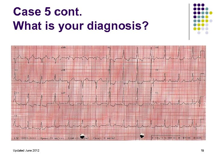 Case 5 cont. What is your diagnosis? Updated June 2012 19 