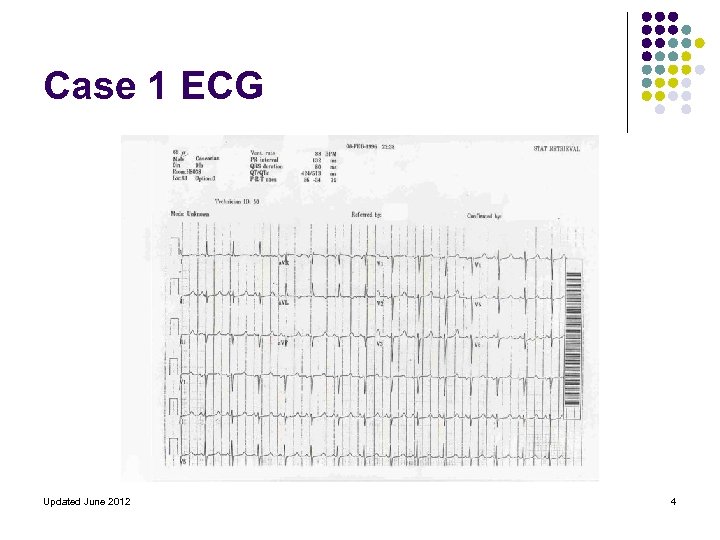 Case 1 ECG Updated June 2012 4 