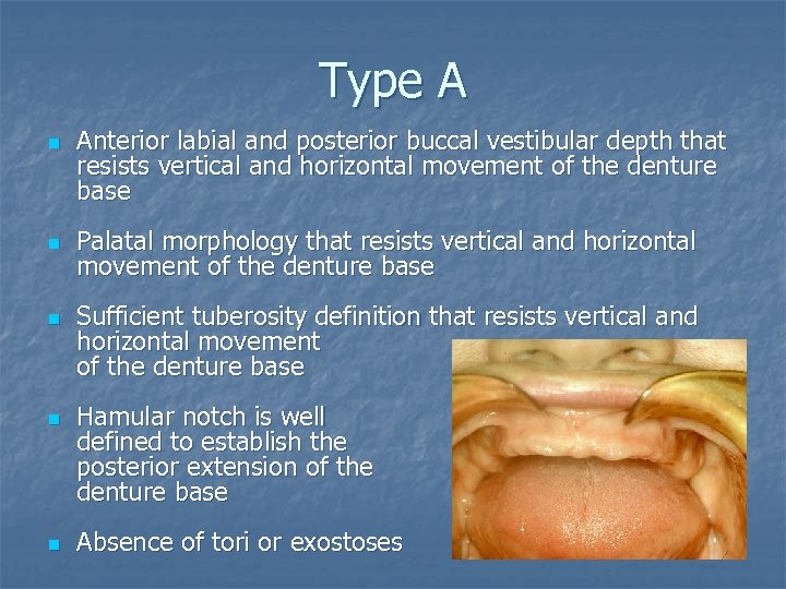 Type A n n n Anterior labial and posterior buccal vestibular depth that resists