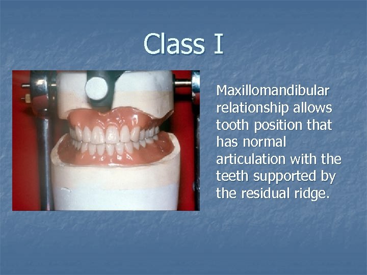 Class I Maxillomandibular relationship allows tooth position that has normal articulation with the teeth