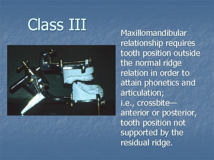 Class III Maxillomandibular relationship requires tooth position outside the normal ridge relation in order