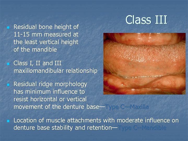 n n Residual bone height of 11 -15 mm measured at the least vertical