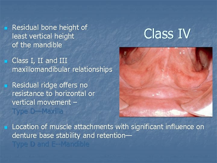 n n Residual bone height of least vertical height of the mandible Class IV