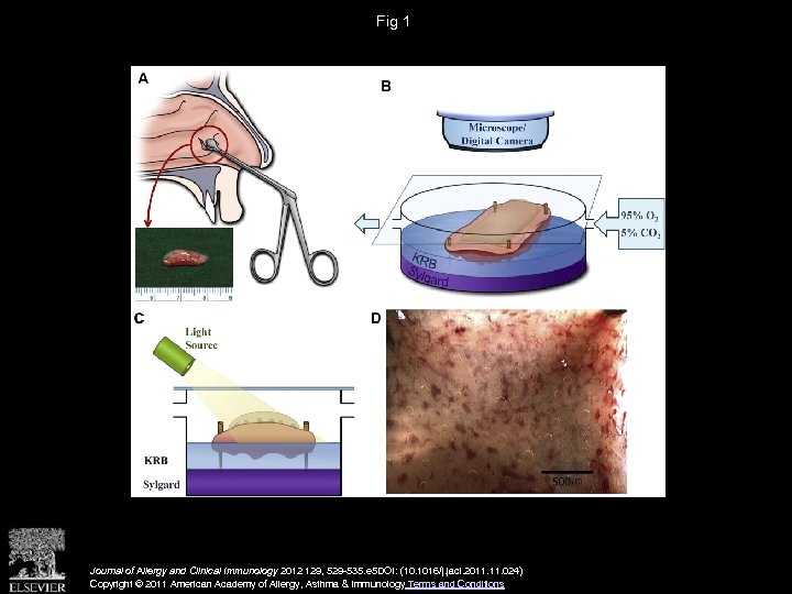 Fig 1 Journal of Allergy and Clinical Immunology 2012 129, 529 -535. e 5
