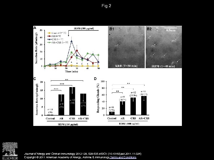 Fig 2 Journal of Allergy and Clinical Immunology 2012 129, 529 -535. e 5